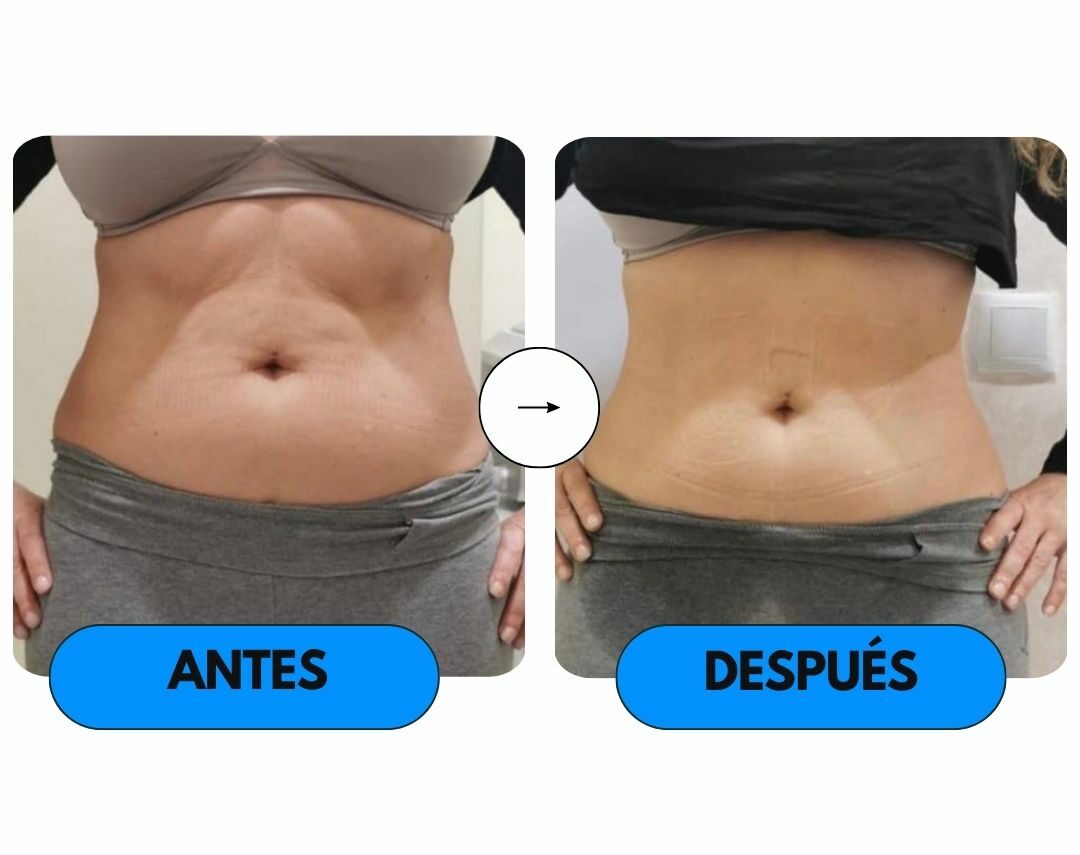 imagen del antes y después de Wonder Axon